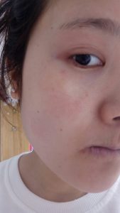 Night cream wipe face pain is why allergic how to do